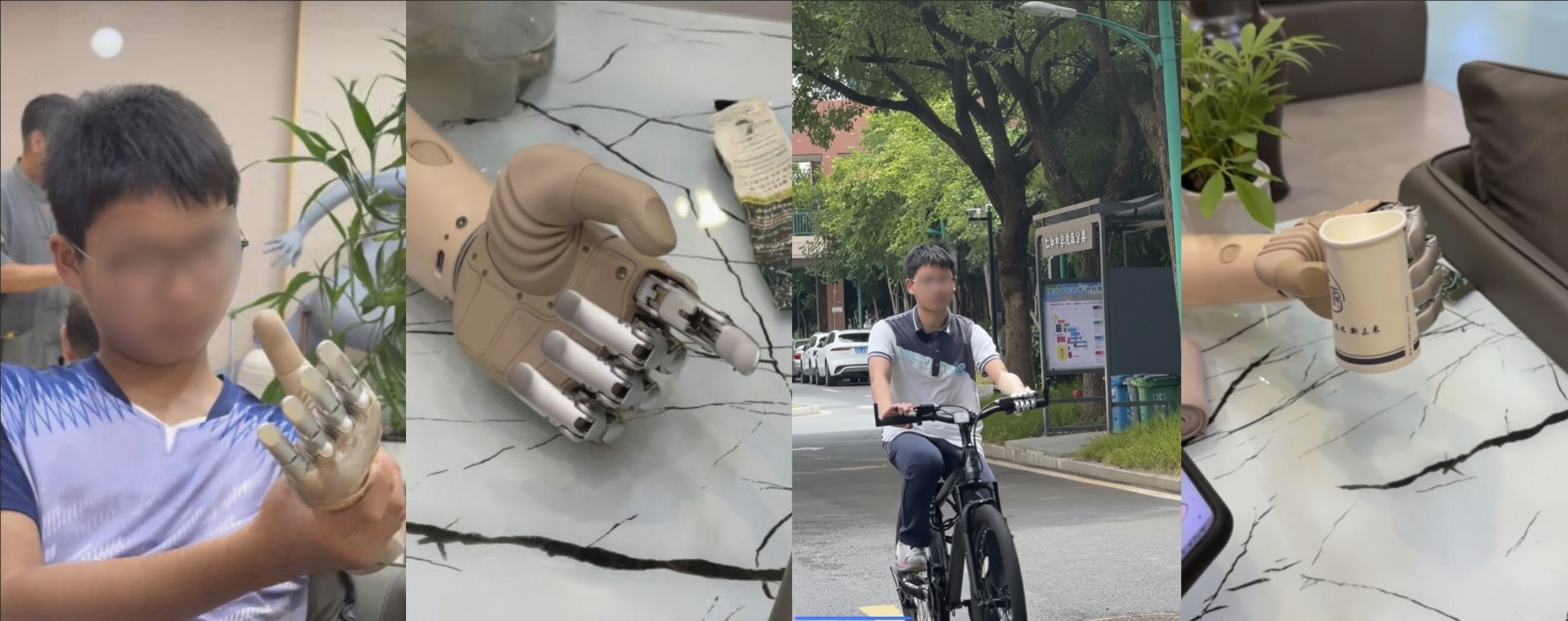 BrainCo Revo1 Bionic Hand